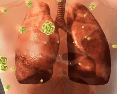 Lucky Plant Green Plants Wood【King of Lung Healing】