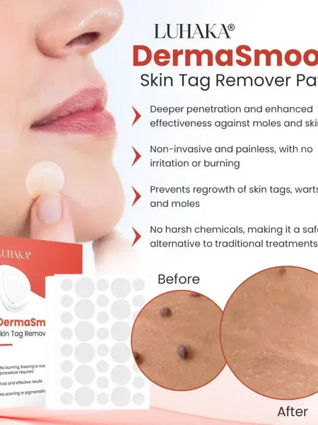 Derma Smooth Skin Tag Removal Patch🔥