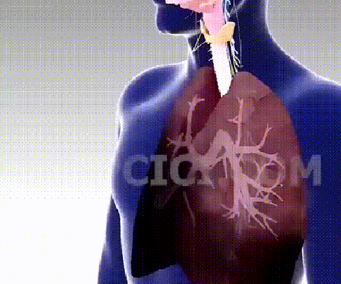 Lucky Plant Green Plants Wood【King of Lung Healing】